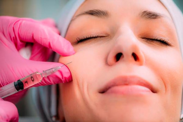 Malar augmentation filler