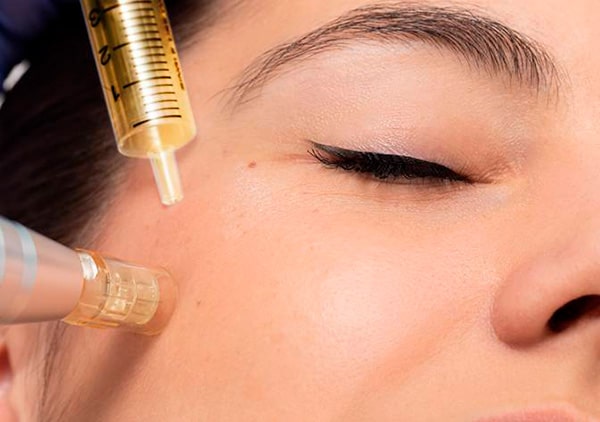 prp microneedling
